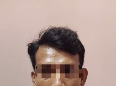 *Penganiayaan di Cikelet Garut Terungkap, Pelaku Ditangkap Polisi Usai Buron ke Bandung*