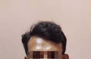 *Penganiayaan di Cikelet Garut Terungkap, Pelaku Ditangkap Polisi Usai Buron ke Bandung*